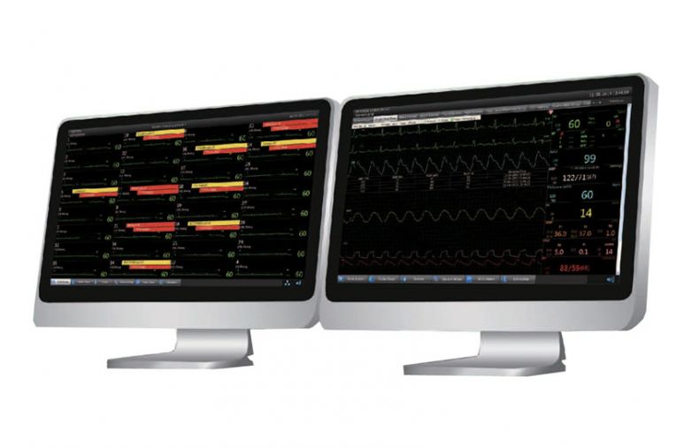 MFM-CMS Sistema Centralizzato di Monitoraggio Paziente